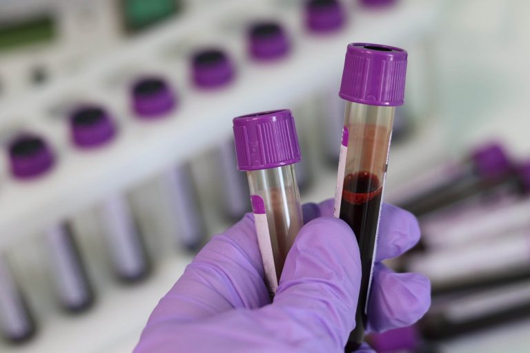 laboratorijska oprema