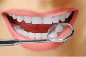lux dental